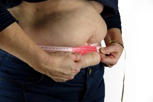 Weight Loss Surgery Cost